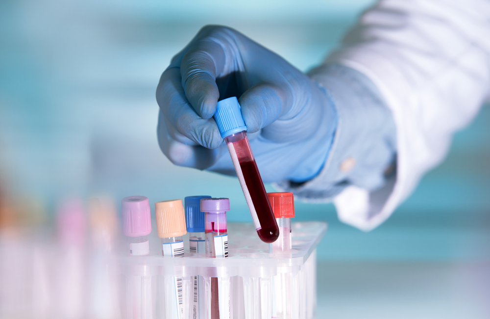 STD Testing and HIV Testing Harm Reduction Florida Addiction Treatment Ambrosia Behavioral Health STD Testing and HIV Testing Harm Reduction Florida Addiction Treatment Ambrosia Behavioral Health